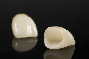 Dental Crown